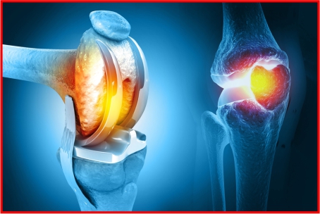 BONE & JOINT SURGERY